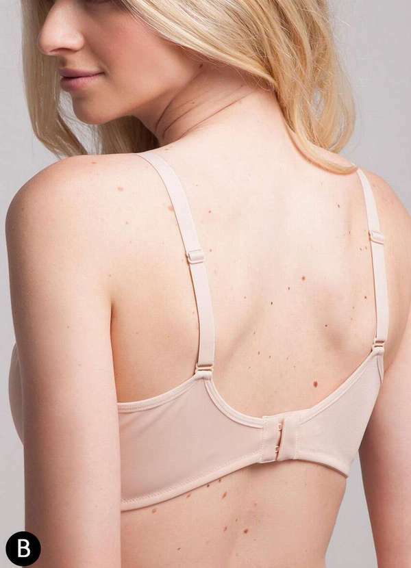 Darling - Sutiã Mastectomia Darling 324.22 Taça B Bas-Base 2